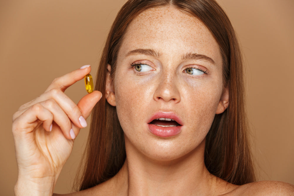 can vitamin C cause acne