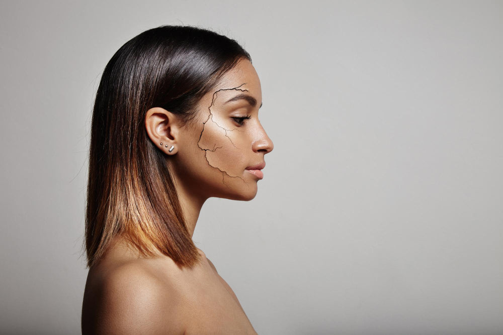 Is Niacinamide Good for Dry Skin? (2024)